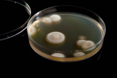 Laboratuvarda mikroorganizmalar ve bakterilerle dolu bir bakteri kabı var.