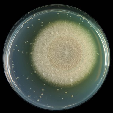 Laboratuvarda mikroorganizmalar ve bakterilerle dolu bir bakteri kabı var.