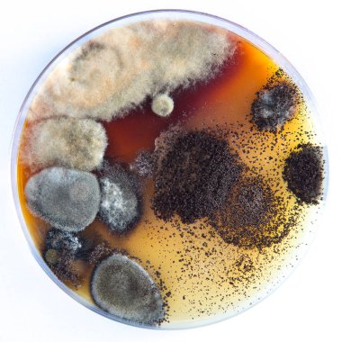 Laboratuvarda mikroorganizmalar ve bakterilerle dolu bir bakteri kabı var.