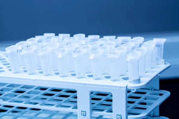 Reageerbuizen Het Laboratorium Geneeskunde Wetenschap — Stockfoto