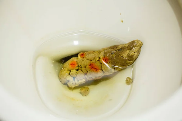 茶色い糞を持つトイレボウル 排泄物で汚れたトイレ — ストック写真