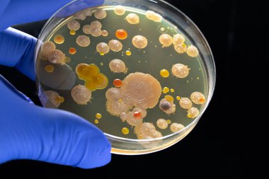 Mavi eldivenli bir bilimsel araştırmacının elinde bakteri ve mantar kirleticileri olan bir petri kabı tutarken. Yeni ilaçların araştırılması için laboratuvar analizi