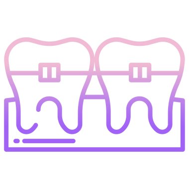 Diş telleri. Basit resimleme