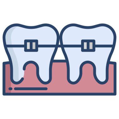Diş telleri. Basit resimleme