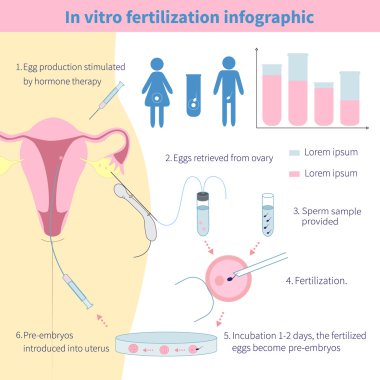 İn vitro fertilizasyon Infographic