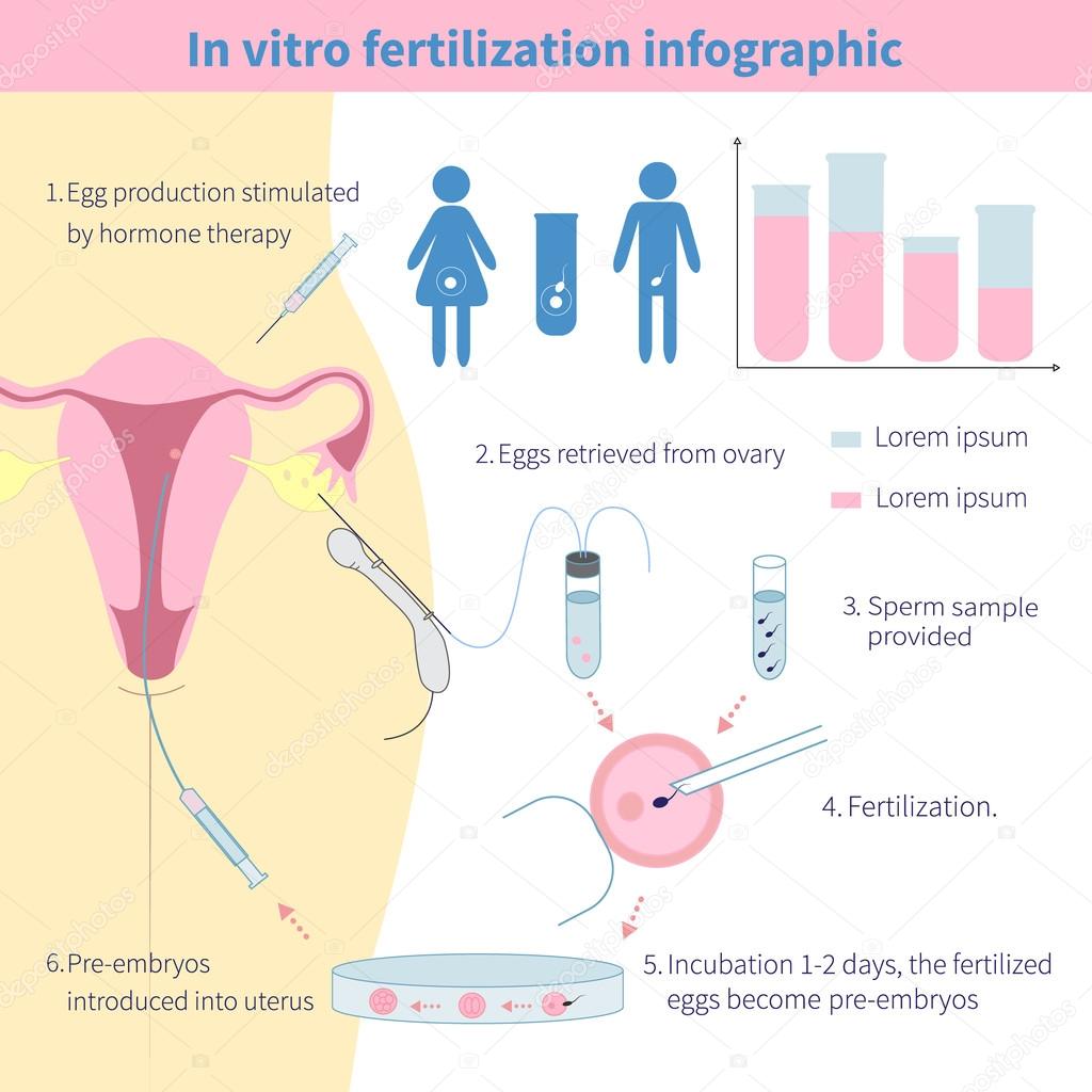 an argument in favor of women request to in vitro fertilisation ivf Fertilisation, webriefly present afurther argument used in this respect is that we proportion of women suffer bleeding at the time of. an argument in favor of women request to in vitro fertilisation ivf Fertilisation, webriefly present afurther argument used in this respect is that we proportion of women suffer bleeding at the time of.