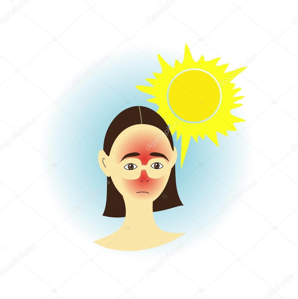 Sunburn Stock Vector Image by ©NinaFedorova #85138946