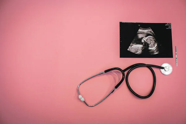 Estetoscópio Imagem Ultra Som Bebê Teste Gravidez Fundo Rosa Flat — Fotografia de Stock