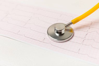 Tıbbi steteskop, kırmızı kalp ve kardiyogram. EKG, kalp dalgası, kalp krizi, kardiyogram raporu. Kardiyogram nabız ve kalp konsepti. Sağlık hizmeti. Metin için boşluk