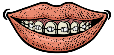 Diş telleri gülümseme rengi çizimi PNG