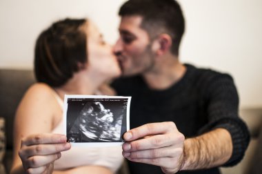 saf sevgi Echography