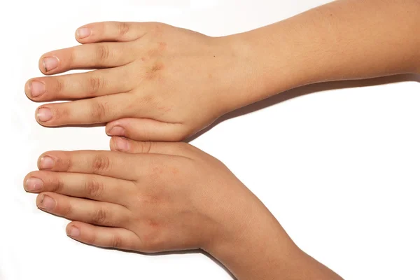 Las manos sucias de un niño sobre un fondo blanco — Foto de Stock