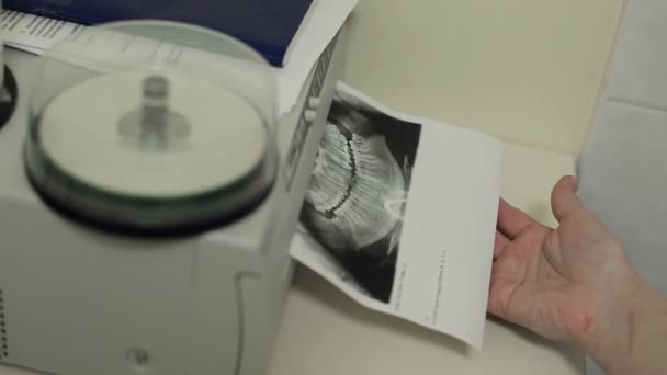 Photo Print X-ray — Stock Video