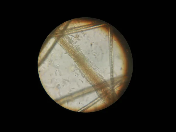 Волосы кошки повреждены дерматофитом Microsporum canis, микроскоп — стоковое фото