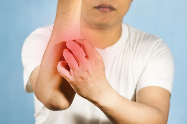 En man skrapa klådan med hand och arm — Stockfoto