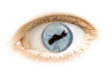 Close-up of an eye with the pupil in the shape of Nova Scotia.(s