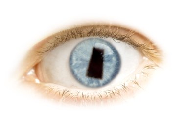 Close-up of an eye with the pupil in the shape of Saskatchewan.(