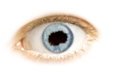 Close-up of an eye with the pupil in the shape of Macedonia.(ser