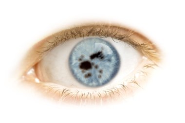 Close-up of an eye with the pupil in the shape of Fiji.(series)