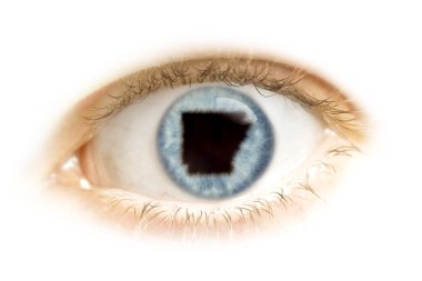 Close-up of an eye with the pupil in the shape of Arkansas.(seri