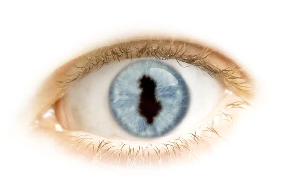Close-up de um olho com o aluno na forma de Albânia. (série — Fotografia de Stock