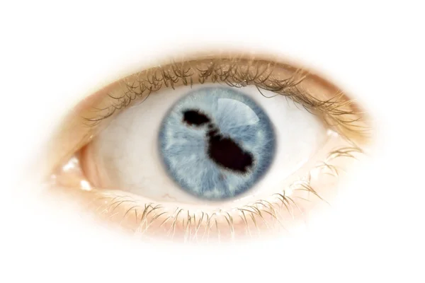Close-up de um olho com o aluno na forma de Malta. (série ) — Fotografia de Stock
