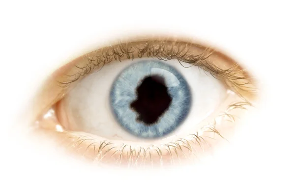 Gros plan d'un œil avec la pupille en forme de Niue. (séries) ) — Photo