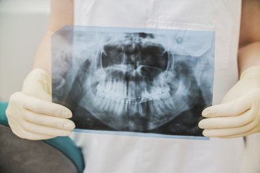 Doktor lastik eldiven tıbbi x-ray diş tutan eller ve kafatası yakın çekim 