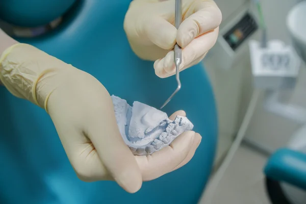 Dentysta Noszenia Rękawic Gumowych Trzyma Zęby Oddanych — Zdjęcie stockowe