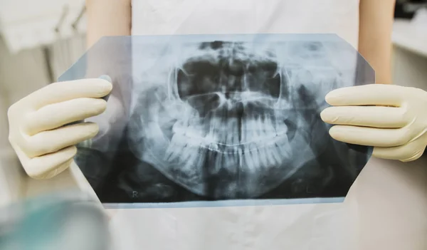 Manos Del Médico Guantes Goma Que Sostienen Los Dientes Rayos — Foto de Stock