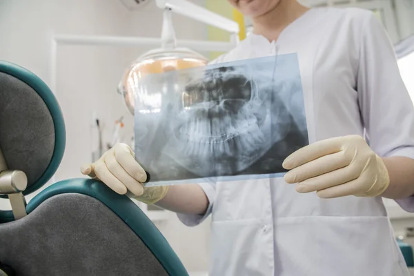 Kobieta Dentysty Sobie Maseczkę Medyczną Ray Gospodarstwa Szpitalu — Zdjęcie stockowe