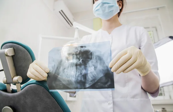 Vrouwelijk Tandarts Dragen Van Medische Masker Bedrijf Ray Ziekenhuis — Stockfoto