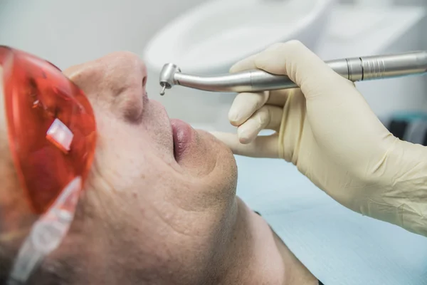 Zbliżenie opieki stomatologicznej pojęcie stomatologii inspekcji. pacjent leży na krześle w stomatologii przed nim rękę z wiertła — Zdjęcie stockowe