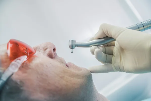 Primer plano concepto de cuidado dental inspección estomatológica. el paciente se acuesta en una silla en odontología delante de él una mano con taladro — Foto de Stock