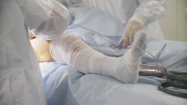 Πόδι του ασθενούς κατά τη διάρκεια χειρουργική επέμβαση ισχίου στο νοσοκομείο. Οι γιατροί λειτουργούν σε έναν ασθενή. μεταμόσχευση της άρθρωσης. — Αρχείο Βίντεο