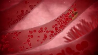 Trombosit ve kolesterol plağıyla tıkanmış arter, obezite veya diyet ve beslenme sorunları için sağlık riski kavramı