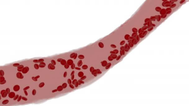 Clogged Arteria placa de colesterol, 4k concepto 3d animación — Vídeo de stock