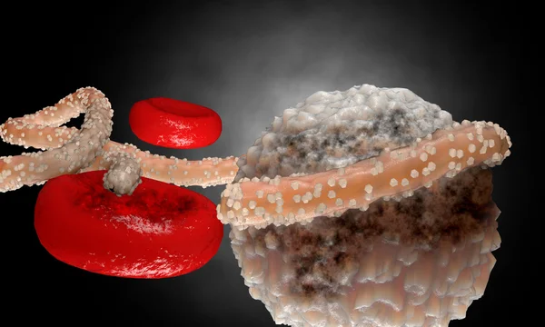 Vírus do ébola, bactérias, vírus, epidemia. 3d realista tornar vírus ébola com células sanguíneas dentro do organismo . — Fotografia de Stock
