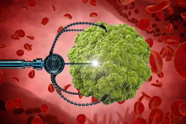 Nanorobot e virus, batteri, microbi. Concetto medico futuro anatomico. Anatomia umana, vista dall'interno dell'organismo — Foto Stock