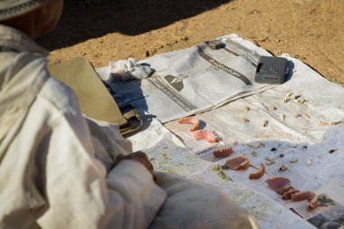 Takma diş topluluğu olan adam