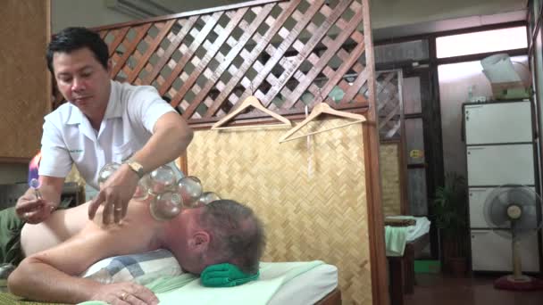 Cupping Leczenie Przepukliny Dysku — Wideo stockowe