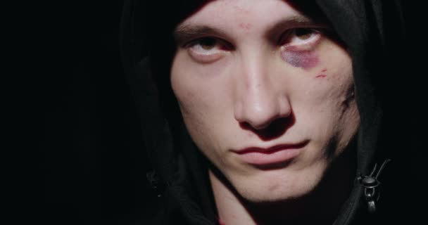 Portret geslagen man met een blauwe plek onder zijn oog op een zwarte achtergrond — Stockvideo