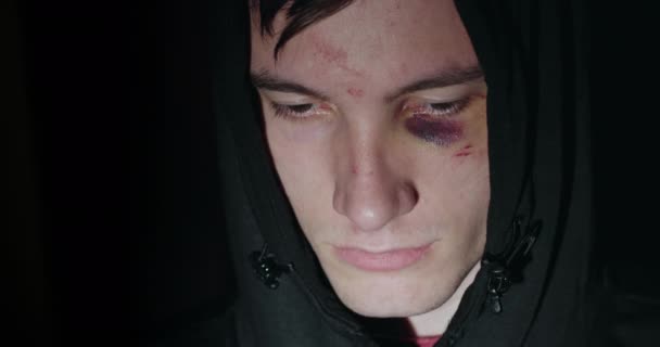 Triste homme à la cagoule avec des ecchymoses et des abrasions sous les yeux — Video