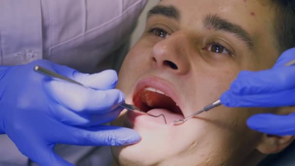 Undersökning av tänderna. Tandläkare kloniska — Stockvideo