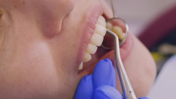 Onderzoek van de tanden close-up — Stockvideo
