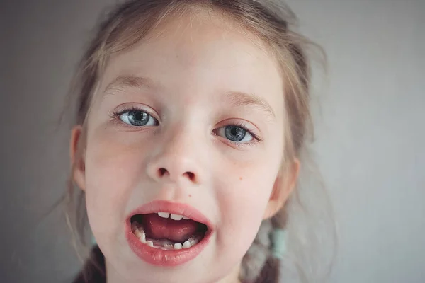 first baby teeth that fell out, portrait of a girl with her front teeth that fell out, childrens dentistry