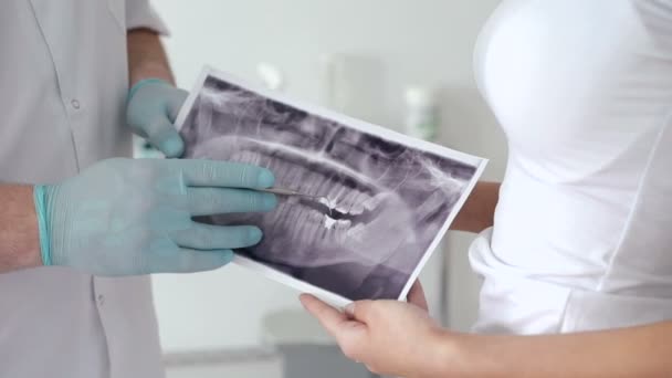 Tandarts met patiënt met behulp van röntgenfoto van tanden — Stockvideo