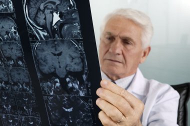 Doktor MRI tarama arıyorsunuz