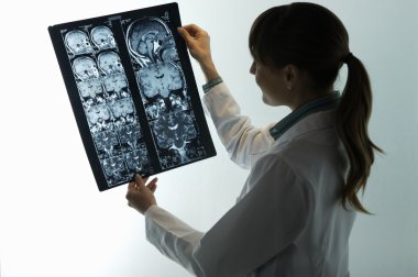 Doktor MRI tarama arıyorsunuz