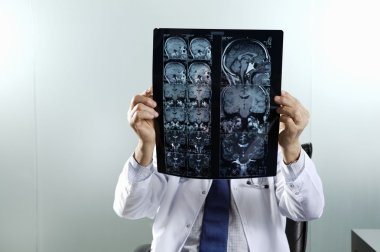 Doktor MRI tarama arıyorsunuz
